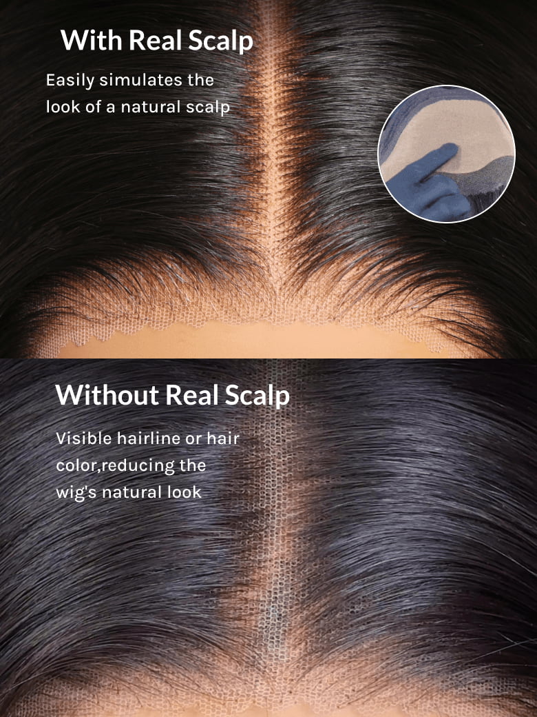 Comparison of wig with real scalp and without real scalp, highlighting the natural look achieved.