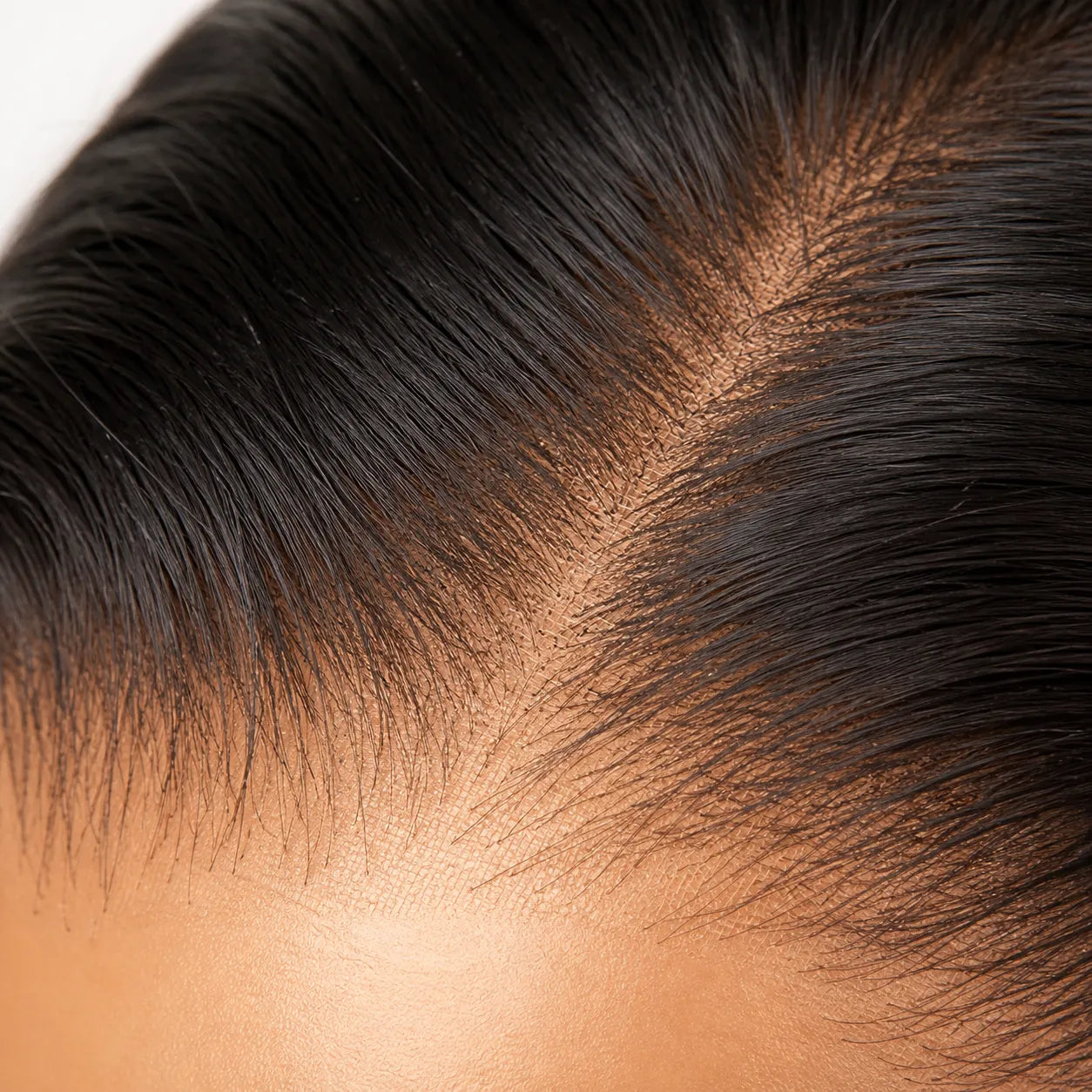 Close-up of a person's scalp with hair growth